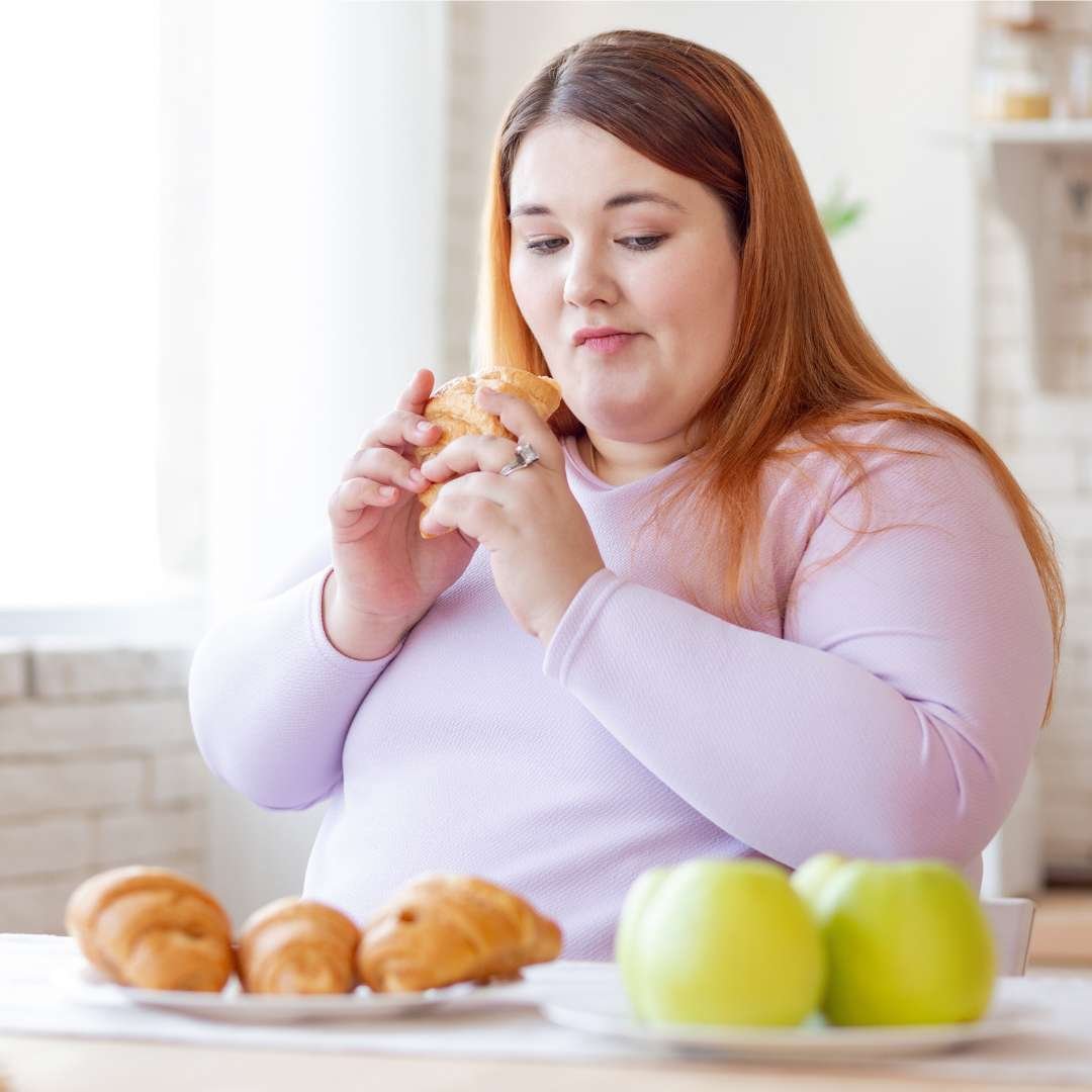 ¿Qué es la Obesidad Mórbida? Dr. Santiago Gomez Correa