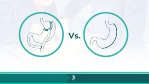 Gastric Sleeve vs Bypass Dr Santiago Gómez Cirujano Bariátrico en Medellín