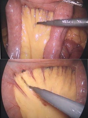 Sección de intestino