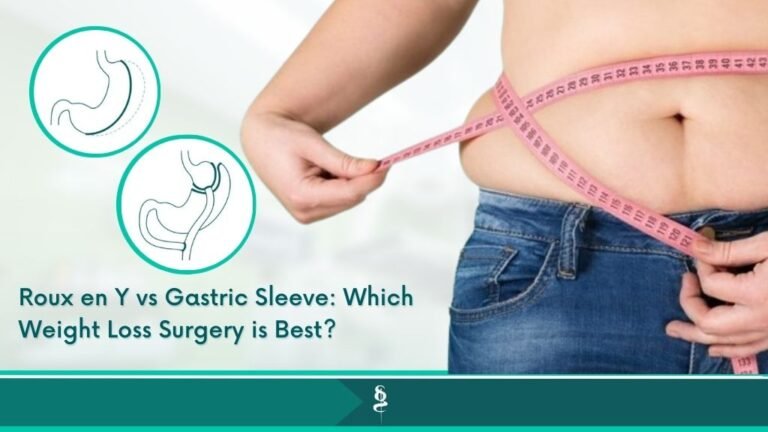 Roux en Y vs Gastric Sleeve: Which Weight Loss Surgery is Best?